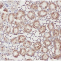 NADH Ubiquinone Oxidoreductase Subunit B11 (NDUFB11) Antibody