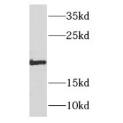 WB analysis of HepG2 cells, using NDUFB11 antibody (1/800 dilution).