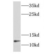 WB analysis of human heart tissue, using NDUFB2 antibody (1/1000 dilution).