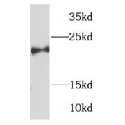 WB analysis of mouse ovary tissue, using NDUFB7 antibody (1/500 dilution).