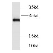 WB analysis of HeLa cells, using NDUFB9 antibody (1/1500 dilution).