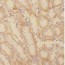 NADH Ubiquinone Oxidoreductase 1 Subunit C2 (NDUFC2) Antibody