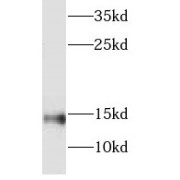 WB analysis of human kidney tissue, using NDUFC2 antibody (1/500 dilution).