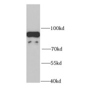 WB analysis of human kidney tissue, using NDUFS1 antibody (1/1000 dilution).