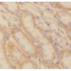 NADH Ubiquinone Oxidoreductase Subunit S5 (NDUFS5) Antibody