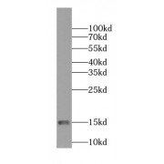 WB analysis of human kidney tissue, using NDUFS5 antibody (1/1000 dilution).