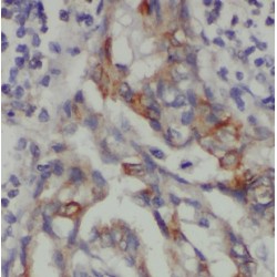 NADH Ubiquinone Oxidoreductase Core Subunit V1 (NDUFV1) Antibody