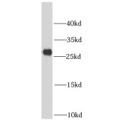 WB analysis of mouse heart tissue, using NDUFV2 antibody (1/1000 dilution).