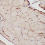 IHC-P analysis of human skeletal muscle tissue, using NEB-Specific antibody (1/50 dilution).