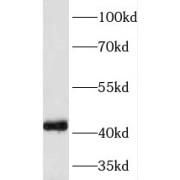 WB analysis of human brain tissue, using NECAB3 antibody (1/500 dilution).