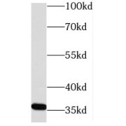 WB analysis of MCF7 cells, using NECAP2 antibody (1/600 dilution).