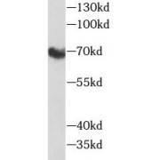 WB analysis of MCF7 cells, using Nectin 2 antibody (1/800 dilution).