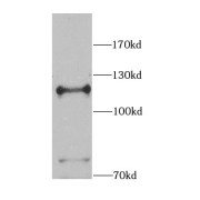 WB analysis of C6 cells, using NEDD4 antibody (1/1000 dilution).