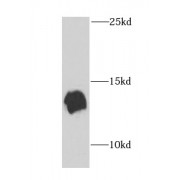 WB analysis of mouse brain tissue, using NEDD8 antibody (1/1000 dilution).