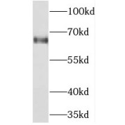 WB analysis of HEK-293 cells, using NEIL3 antibody (1/500 dilution).