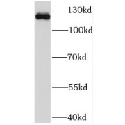 WB analysis of HeLa cells, using NEK9 antibody (1/500 dilution).