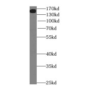 WB analysis of human brain tissue, using Neogenin-Specific antibody (1/500 dilution).