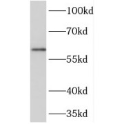 WB analysis of SH-SY5Y cells, using NETO2 antibody (1/500 dilution).