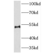 WB analysis of Y79 cells, using NEUROD4 antibody (1/1000 dilution).