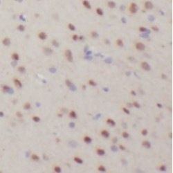 Neurogranin (NRGN) Antibody