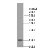 WB analysis of mouse brain tissue, using NRGN antibody (1/1000 dilution).