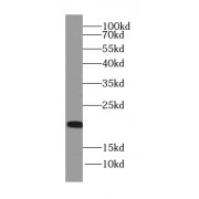 WB analysis of human liver tissue, using NRTN-Specific antibody (1/400 dilution).