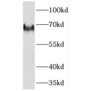 WB analysis of HeLa cells, using NF2 antibody (1/1000 dilution).