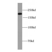 WB analysis of pig brain tissue, using NF200 antibody (1/4000 dilution).