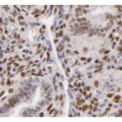 NF45 Antibody