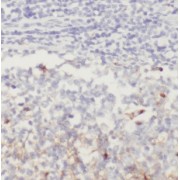 IHC-P analysis of human tonsillitis tissue, using NFAM1 Antibody (1/50 dilution).