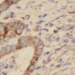 Nuclear Factor, Erythroid 2 (NFE2) Antibody