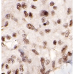 Nuclear Factor Erythroid 2-Related Factor 1 (NFE2L1) Antibody