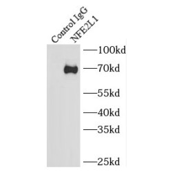 Nuclear Factor Erythroid 2-Related Factor 1 (NFE2L1) Antibody