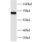 WB analysis of mouse skeletal muscle tissue, using NFE2L1 antibody (1/500 dilution).