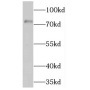 WB analysis of human placenta tissue, using NFE2L3 antibody (1/500 dilution).