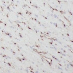 NF-H Antibody