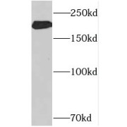 WB analysis of mouse brain tissue, using NEFH antibody (1/500 dilution).