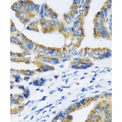 Nuclear Factor NF-Kappa-B P105 Subunit (NFKB1) Antibody