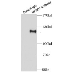 Nuclear Factor NF-Kappa-B P105 Subunit (NFKB1) Antibody