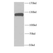 WB analysis of MCF7 cells, using NFKB1 antibody (1/1000 dilution).