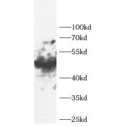 WB analysis of HeLa cells, using NFKB2 antibody (1/500 dilution).