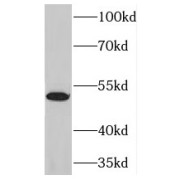 WB analysis of human spleen tissue, using NFKBIE antibody (1/500 dilution).