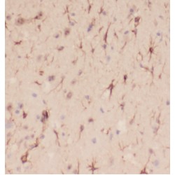 Neurofilament Light Polypeptide (NEFL) Antibody