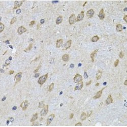 NFU1 Iron-Sulfur Cluster Scaffold (NFU1) Antibody