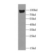 WB analysis of mouse kidney tissue, using NHE8 antibody (1/500 dilution).