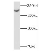 WB analysis of human placenta tissue, using NID2 antibody (1/400 dilution).