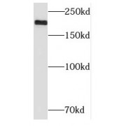 WB analysis of human placenta tissue, using NID2 antibody (1/400 dilution).