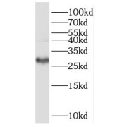 WB analysis of HeLa cells, using NIP30 antibody (1/500 dilution).