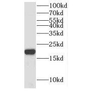 WB analysis of mouse liver tissue, using NIP7 antibody (1/500 dilution).