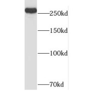 WB analysis of HeLa cells, using NIPBL antibody (1/800 dilution).